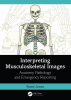 _OceanofPDF_com_Interpreting_Musculoskeletal_Images_Rosie_Jones.pdf